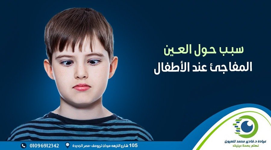 سبب الحول العين المفاجىء عن الاطفال