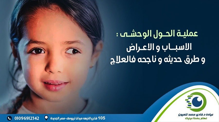 عملية الحول الوحشى