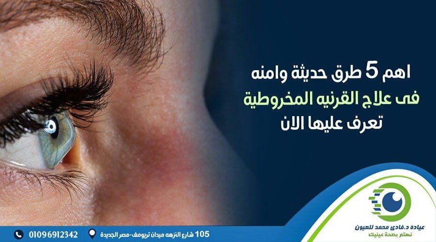 علاج القرنية المخروطية