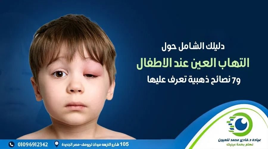 التهاب العين عند الاطفال