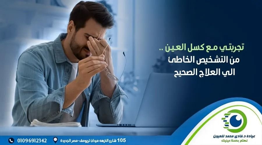 تجربتي مع كسل العين