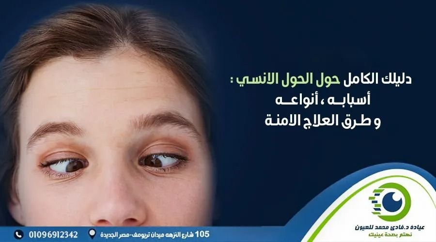 الحول الانسي