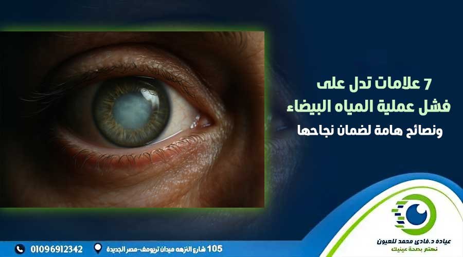 علامات فشل عملية المياه البيضاء