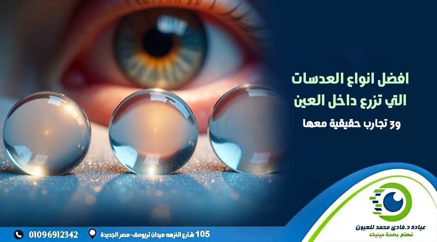 افضل انواع العدسات التي تزرع داخل العين