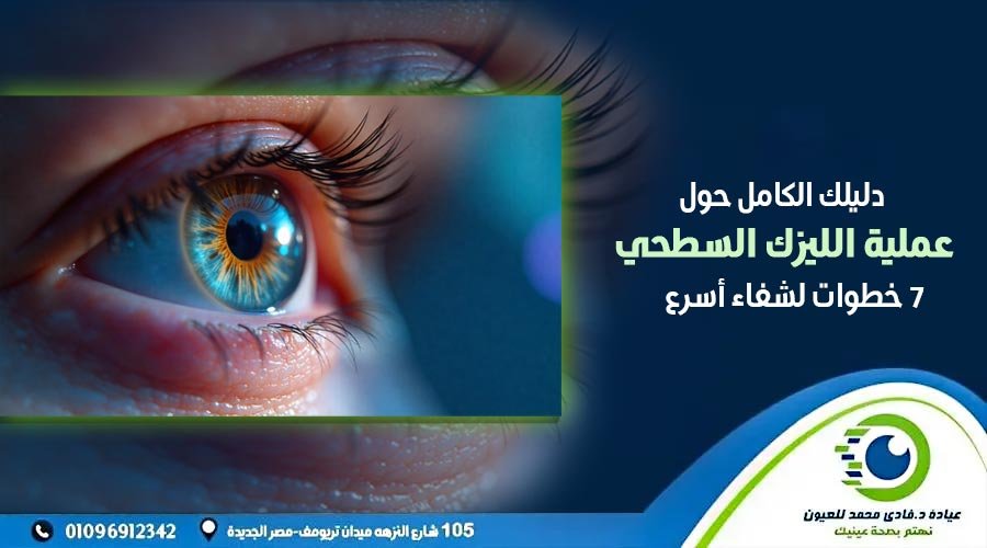 عملية الليزك السطحي