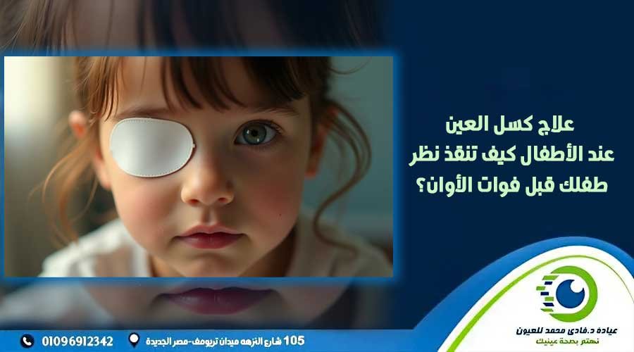 علاج كسل العين عند الاطفال